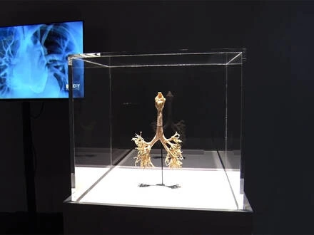 Anatomický model plic v akrylovém skleněném vitrínovém rámu.